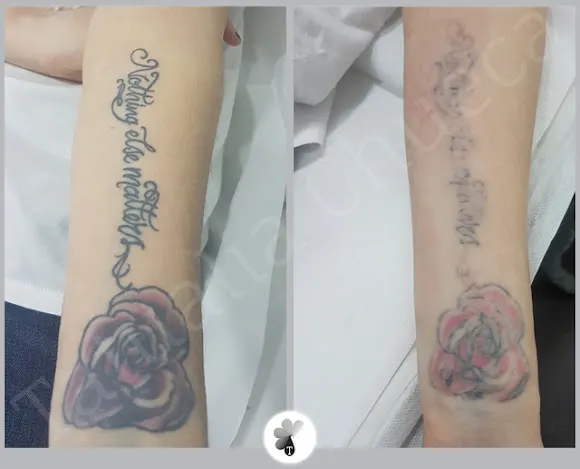 Tatualia Chueca