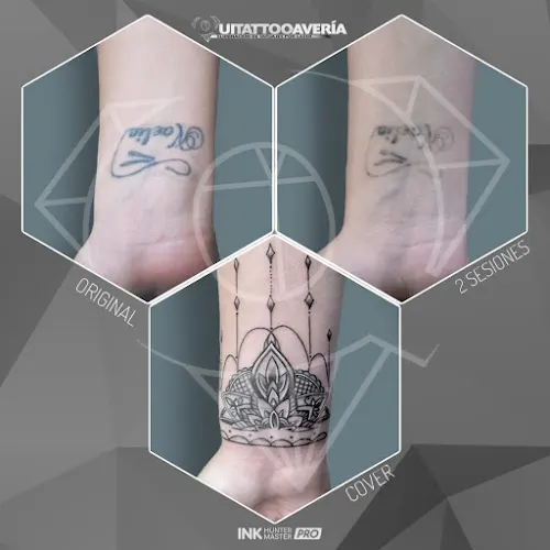 Eliminación de Tatuajes Dos Hermanas - QUITATTOOAVERIA - Dos Hermanas